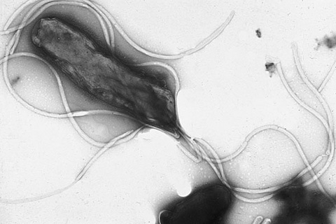 電子顕微鏡で見たピロリ菌
